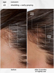 FutureIQ™ biomimetic hair longevity serum